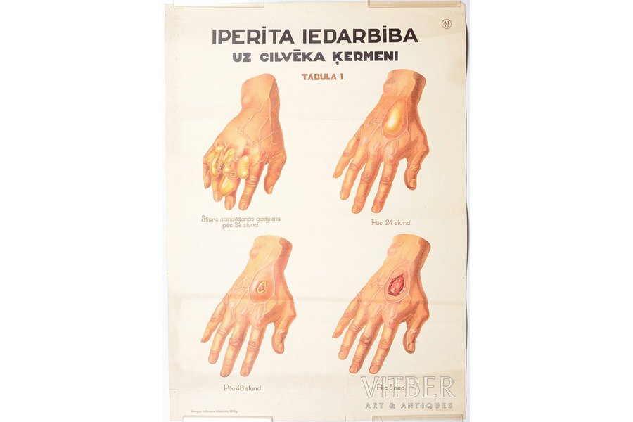 plakāts, Iprīta iedarbība uz cilvēka ķermeni, Latvija, 1933 g., 69.9 x 49.8 cm, izdevējs - Armijas inženieris